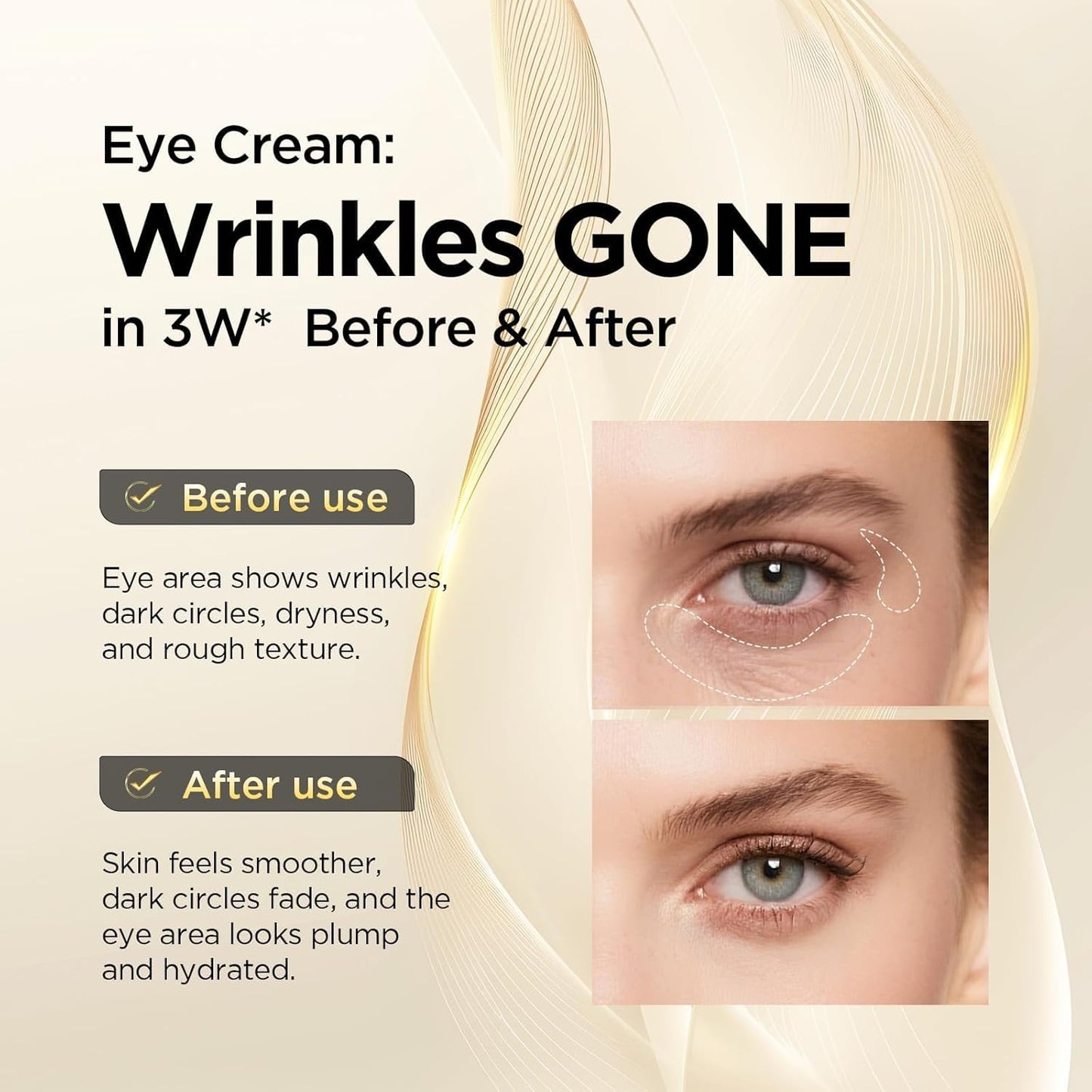 Renew Your Eye Area | Fade Lines & Dark Circles Instantly