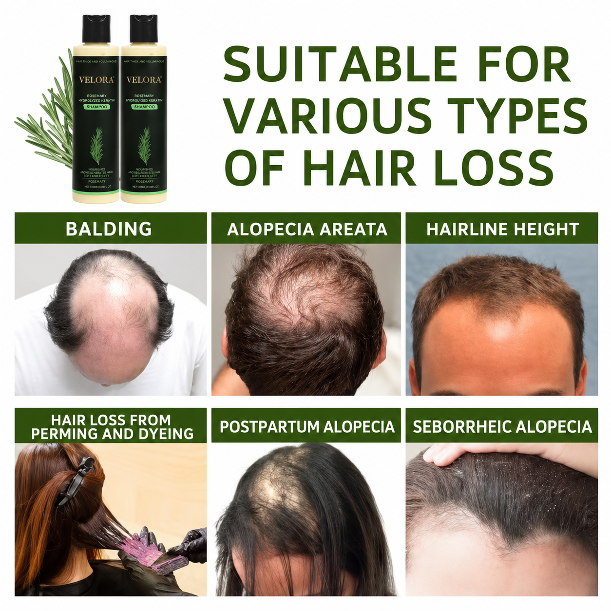 VELORA Rosemary Shampoo, Stimulate Regrowth for Thick Voluminous Hair